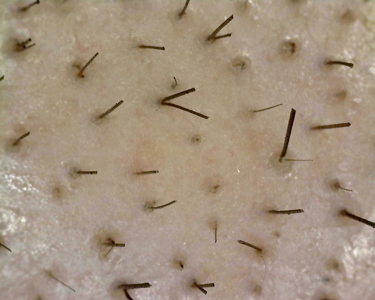Tricologia Médica
