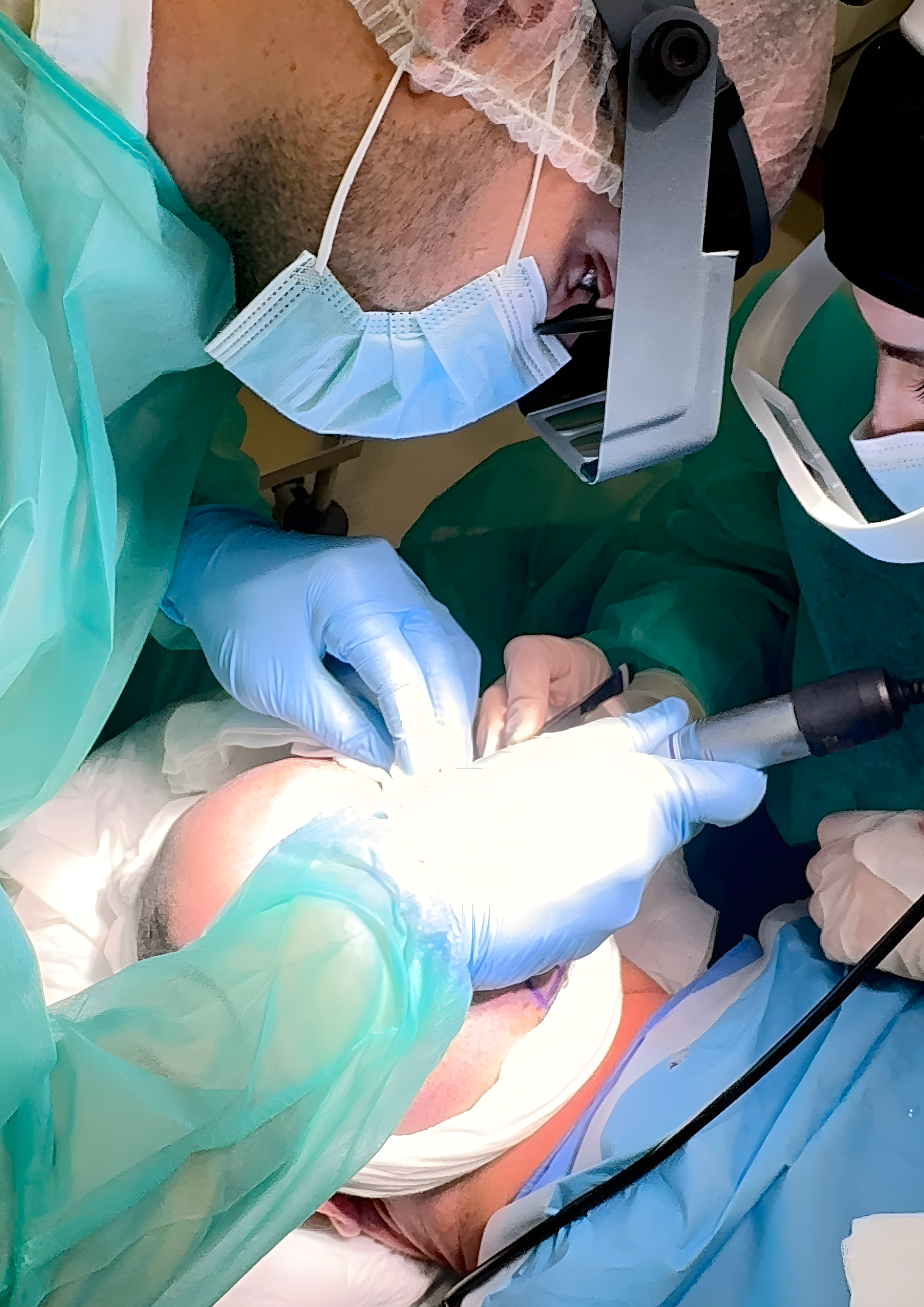 Transplante DHI
